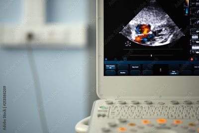 Aorta Ultrasound